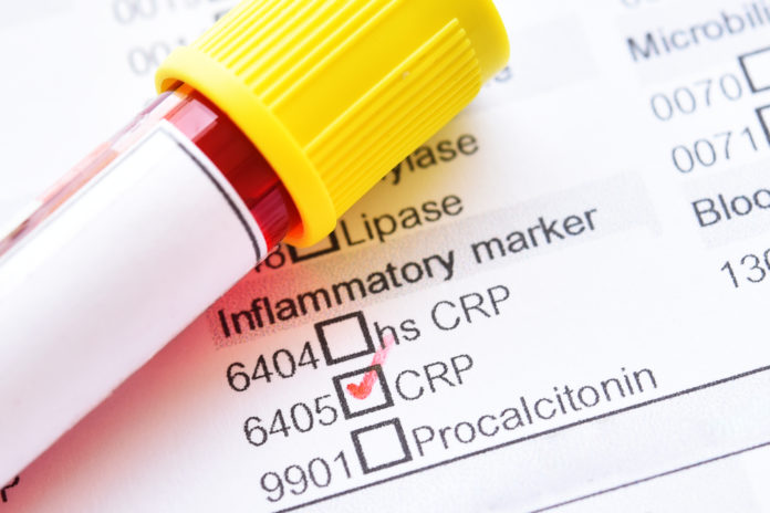 CVD Biomarker Screening Yields No Additional Information