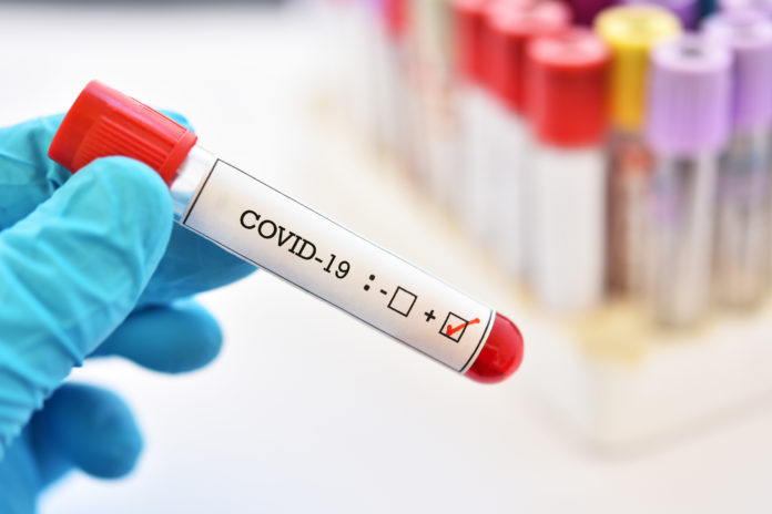 COVID-19, baricitinib, coronavirus