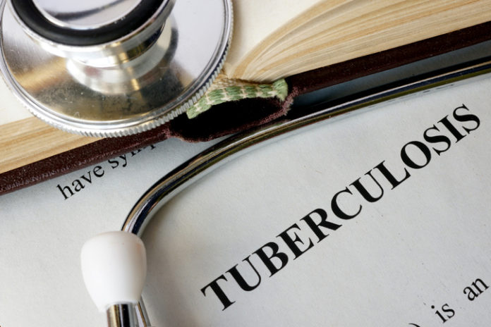 Secukinumab Does Not Increase Risk of TB Reactivation in Rheumatic Disease Patients