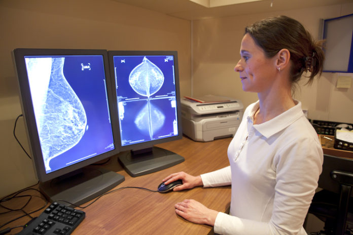 Artificial Intelligence May Help Improve Detection of Breast Cancer on Mammography