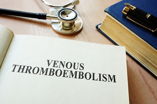 VTE Venous Thromboembolism Risk Low to Moderate in COVID-19 Patients