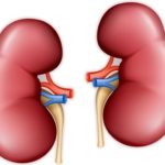 kidney injury