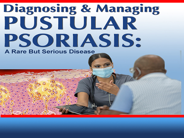 Pustular Psoriasis: Recognizing and Treating A Rare But Serious Disease